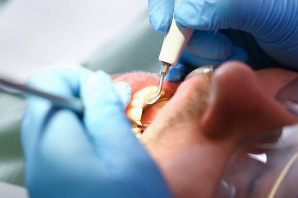 Best Dentist for Tooth Abscess  in Monroeville, OH